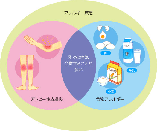 アレルギー疾患図解