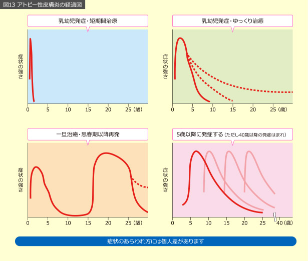 図13 アトピー性皮膚炎の経過図