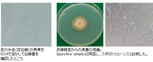 水虫の角質/真菌の培養　写真